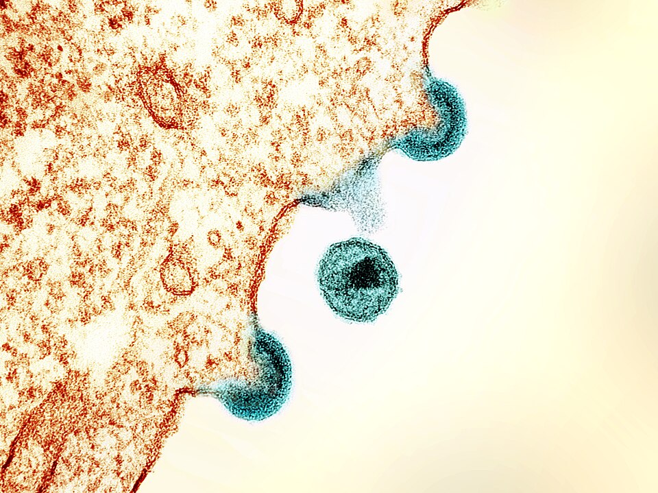 Colourised electron micrograph of HIV-1 particles from cultured cells.