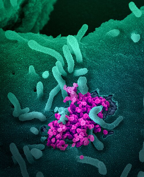 Colourised scanning electron micrograph of SARS-CoV-2 emerging from cultured cells.