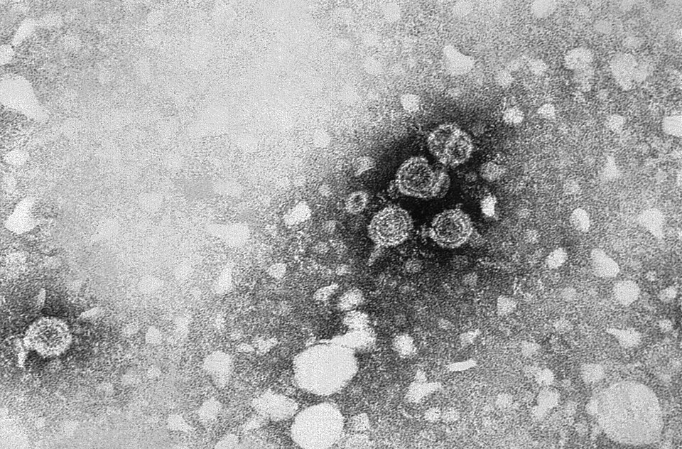 Hepatitis B virus particles in an electron micrograph